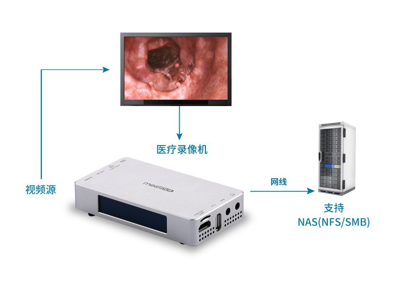 超高清4K医疗录像机，轻便型 - 图片 4